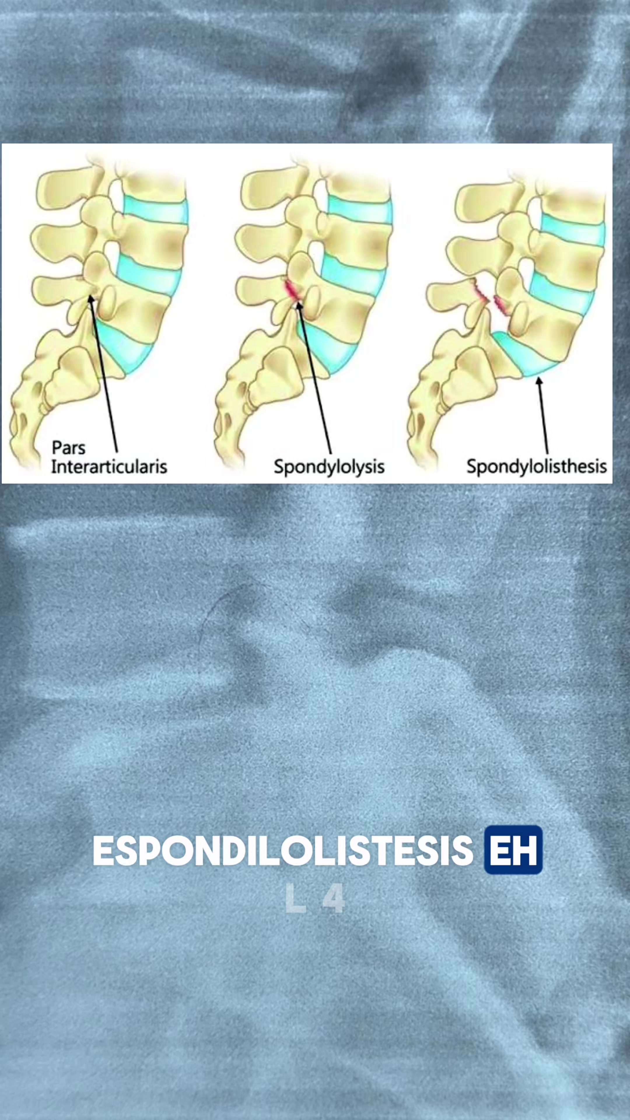 @FisioyquiroLag