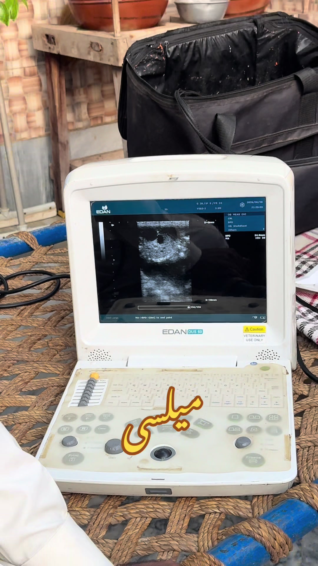 @Dr.Mohsin