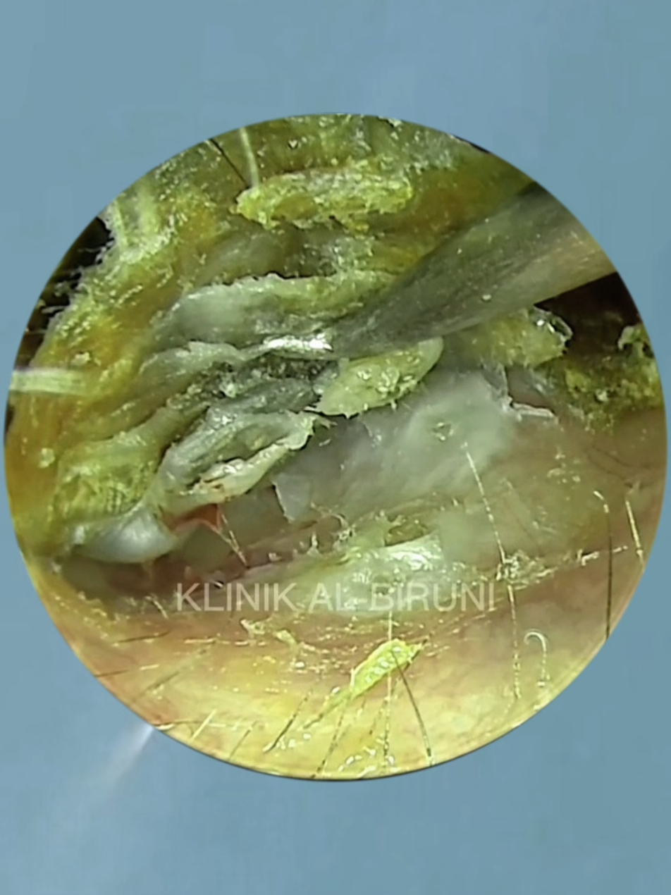 @Earwax.pro