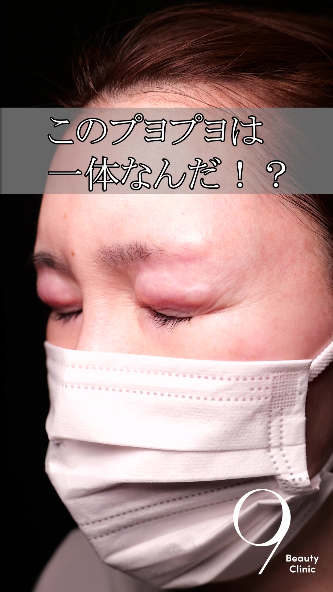 @りく先生　目元切開/クマ治療