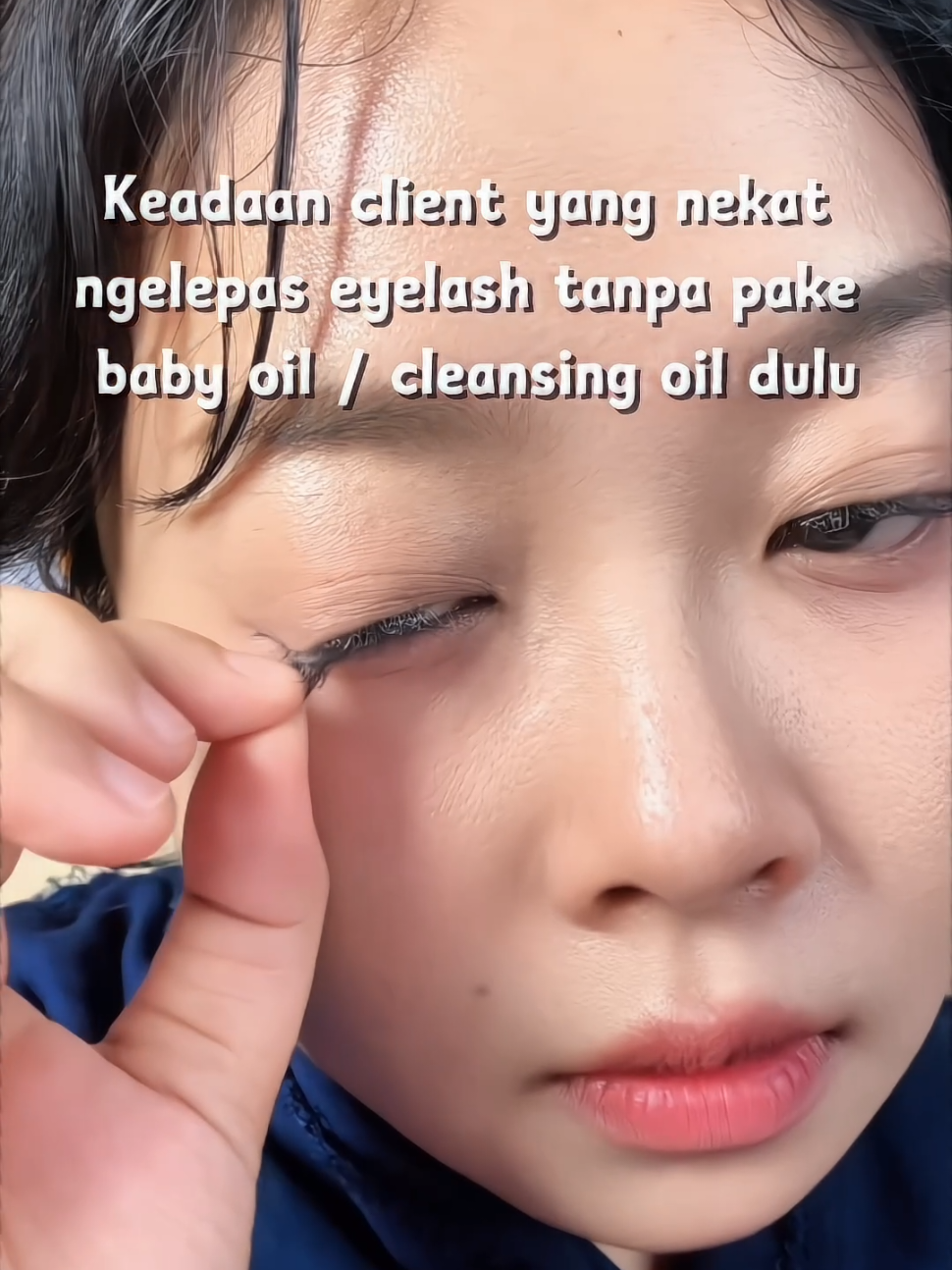 @CANCER BITE