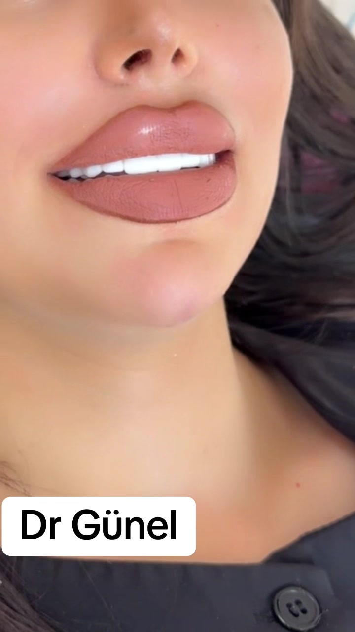 @Dentist_Günel