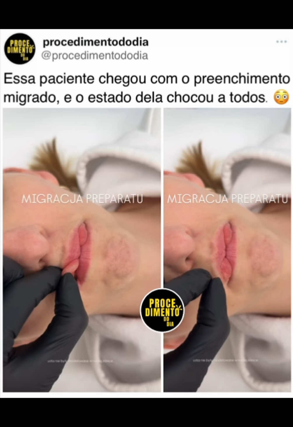 @procedimentododia