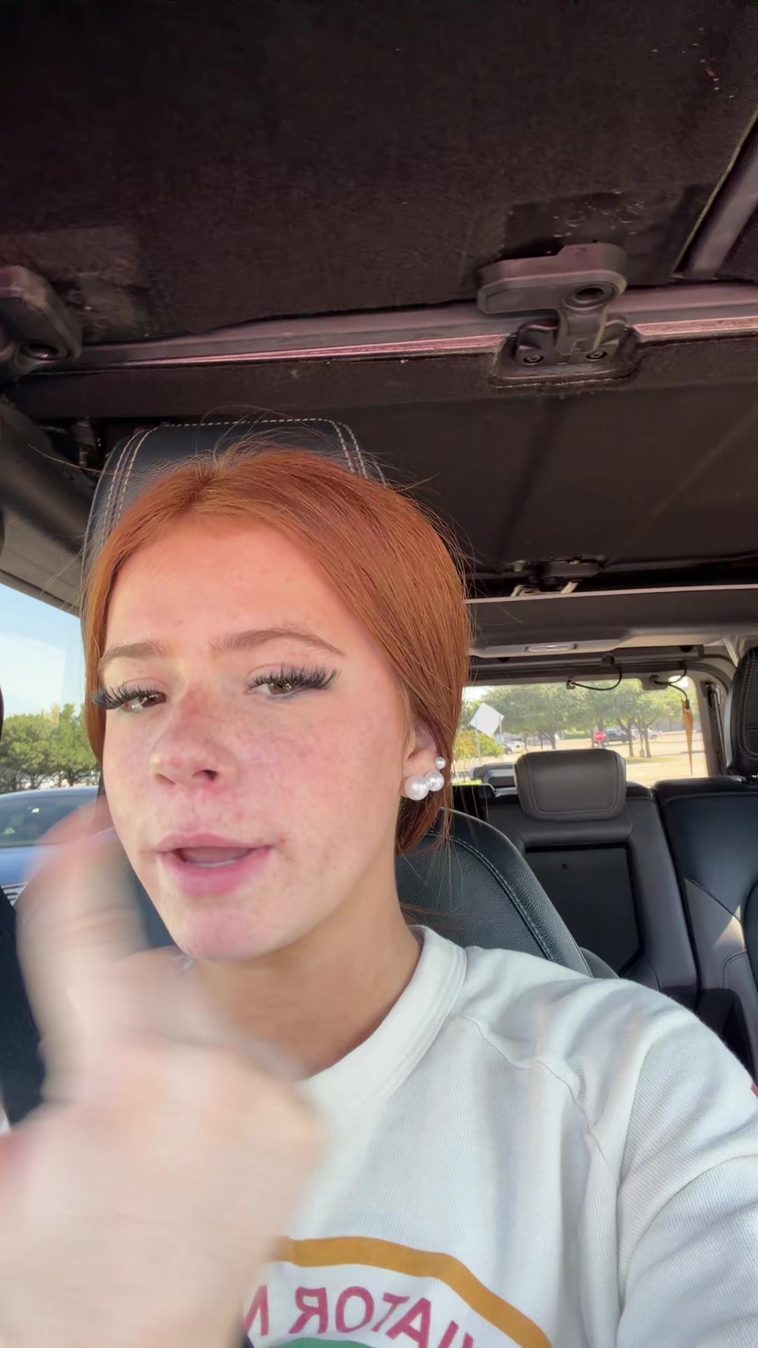 @harperpigmintation