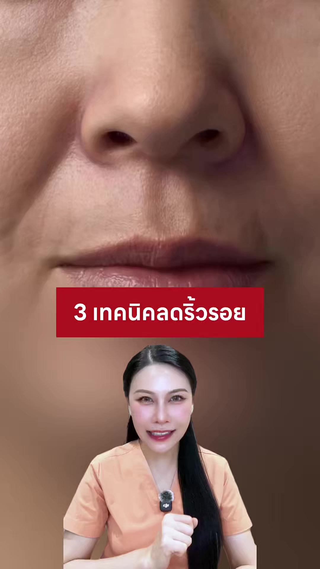 @พยาบาลอัญ