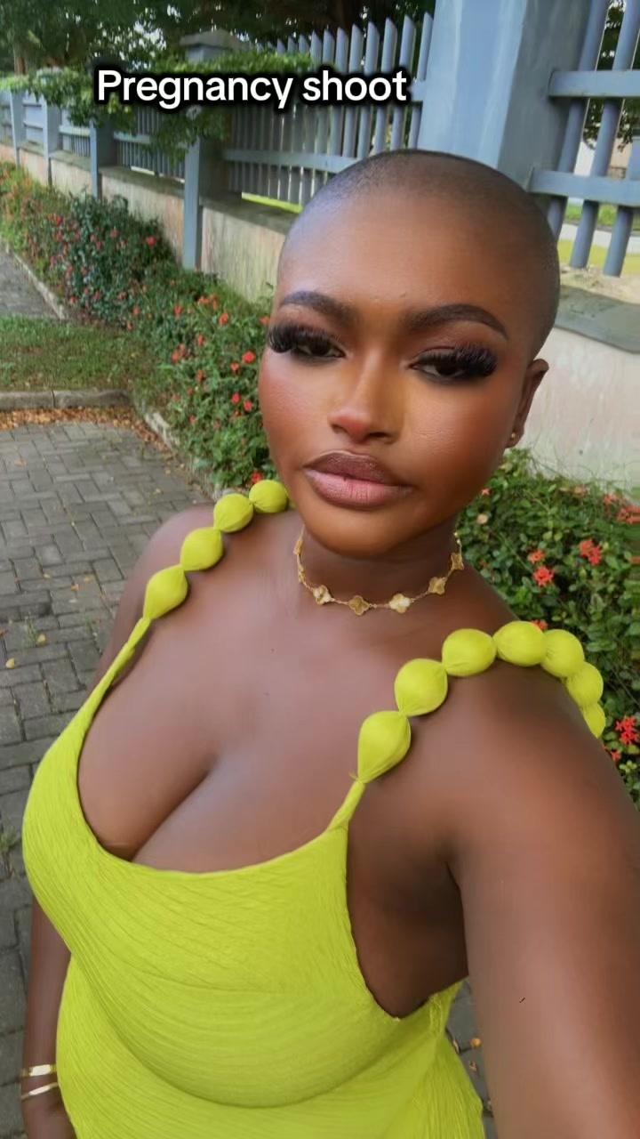 @Baldheadgirl