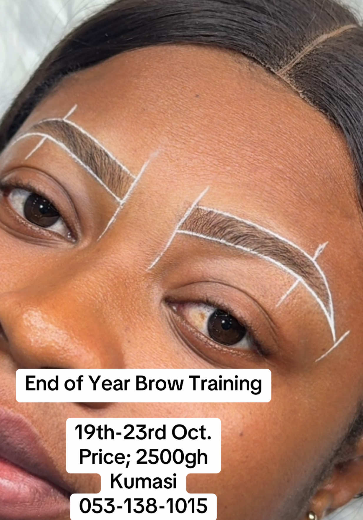 @the_brow_surgeon