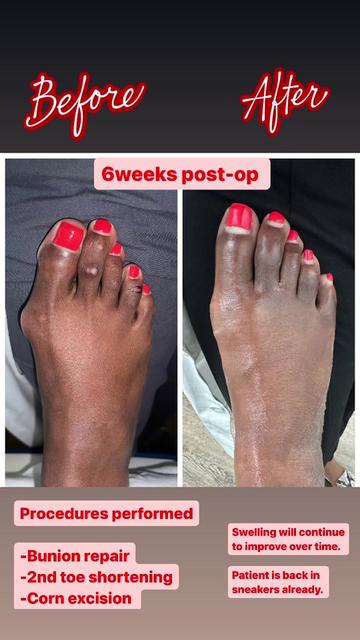 @Deniel Foot and Ankle Center