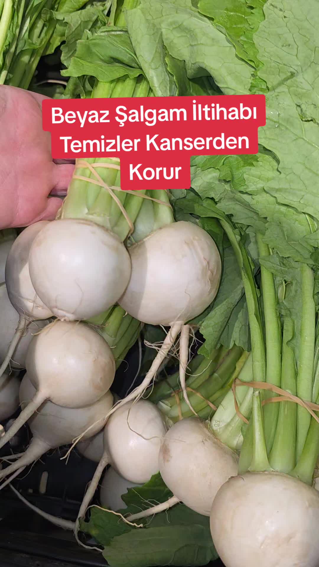 @Gurbetana27