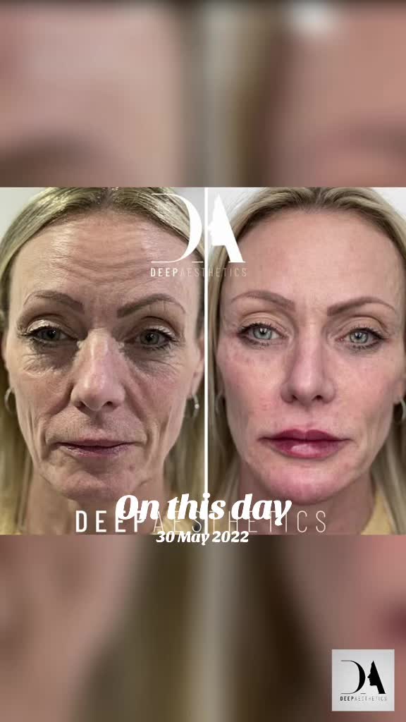 @deepaesthetics_official
