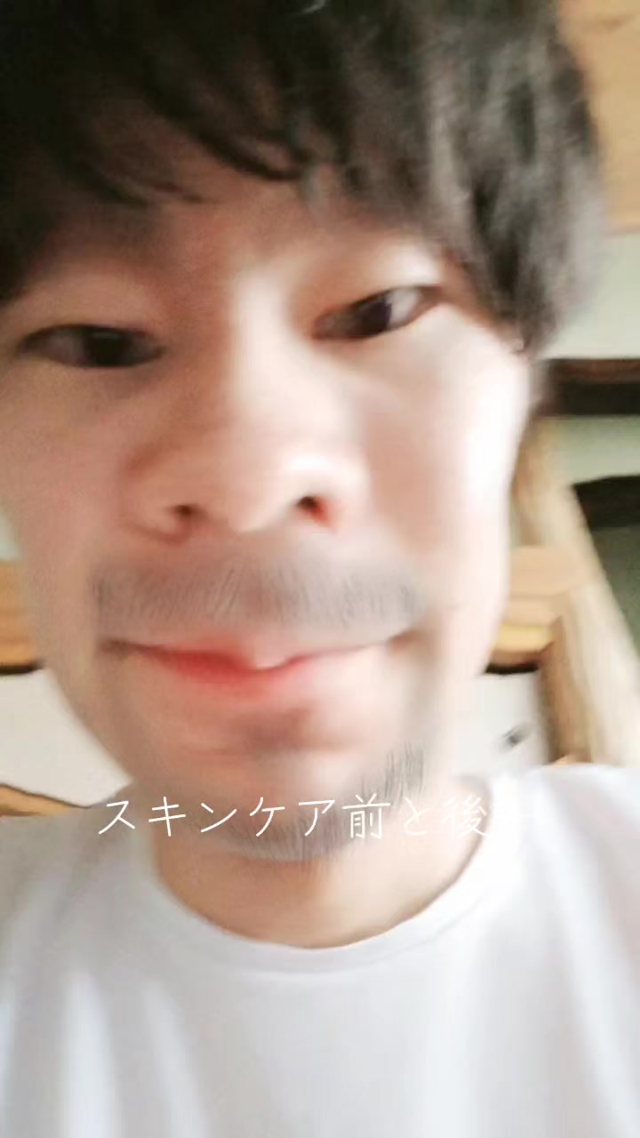 @just_r30โค๐ฉน๐๐ฆ
๐