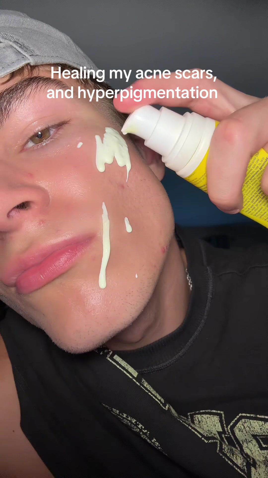 @Finn