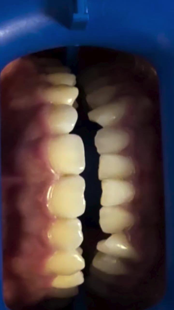@GabeApreza