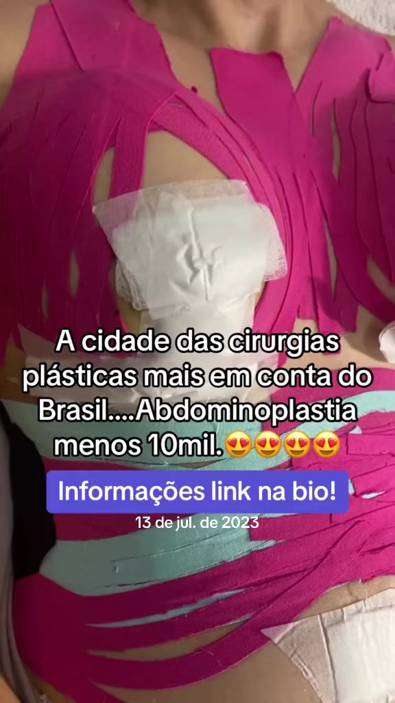 @assessoriaplastica