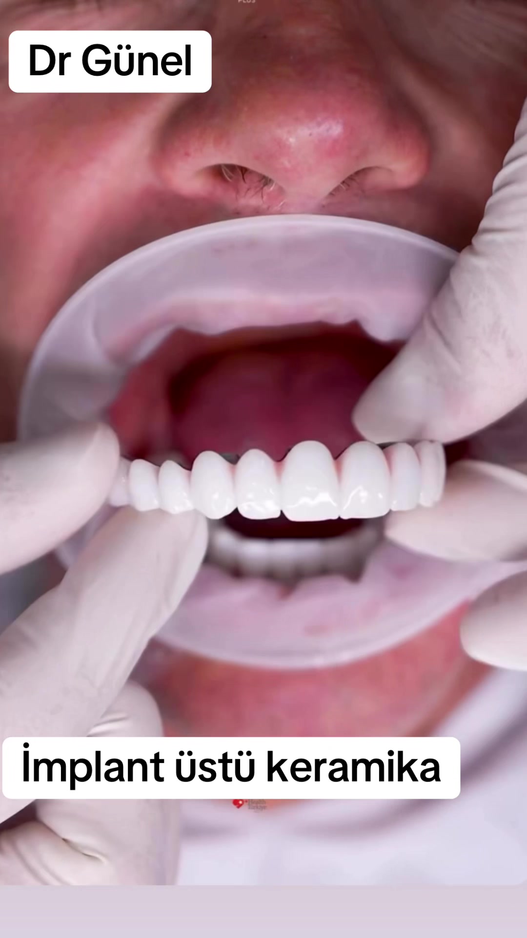 @Dentist_Günel