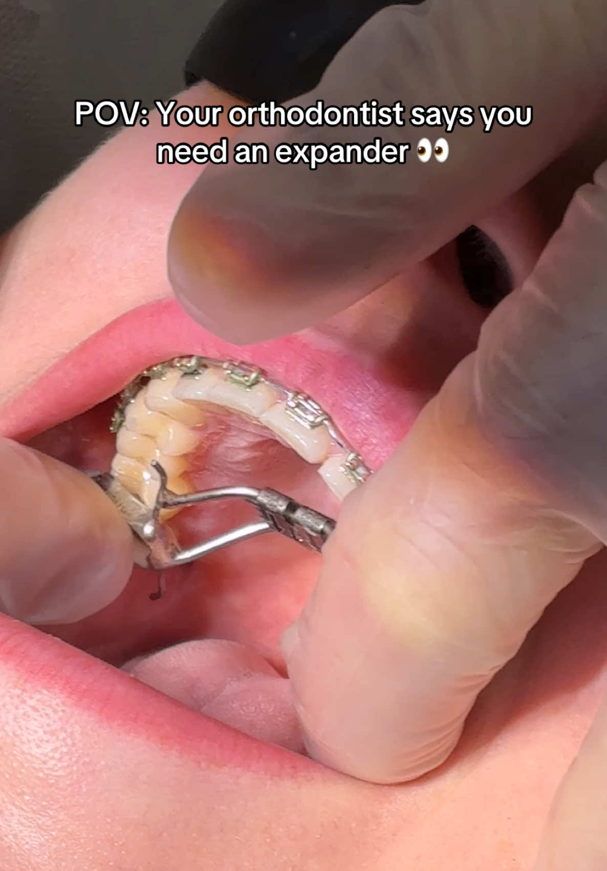 @Woodland Hills Orthodontist