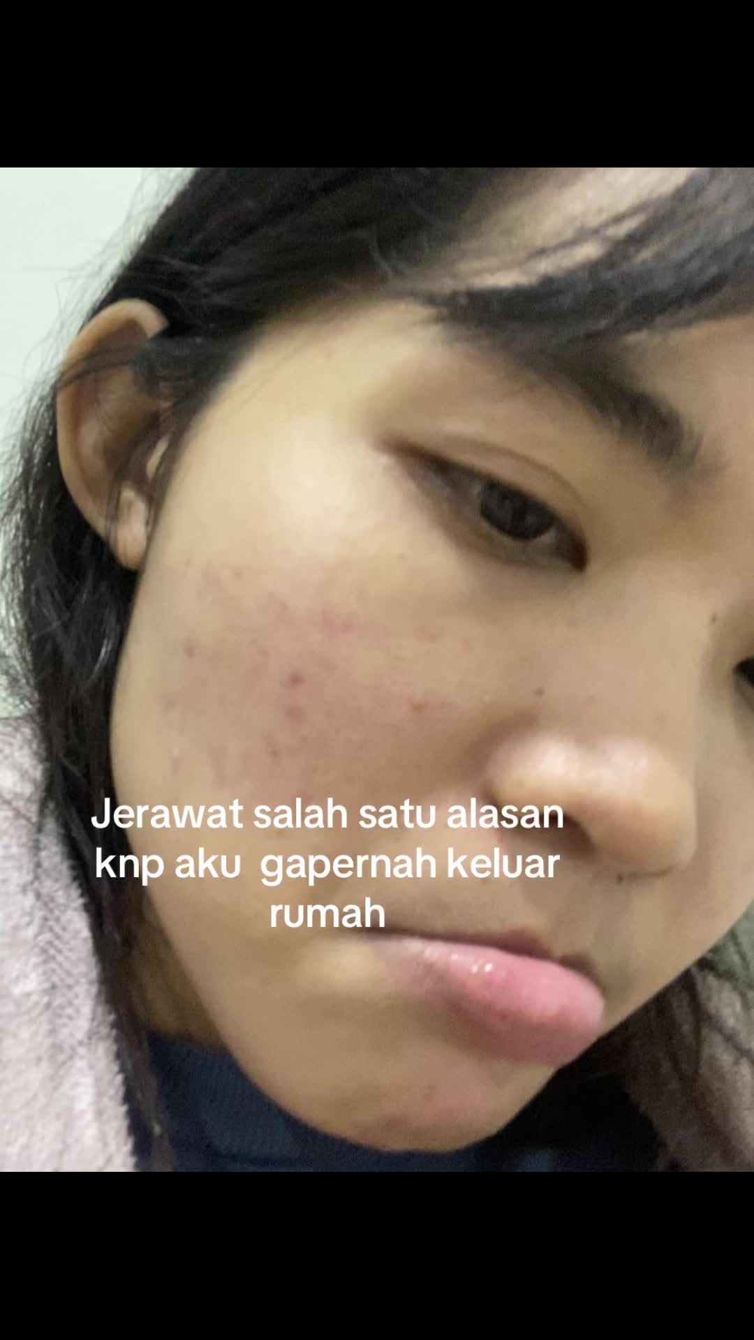 @acnefighter ew