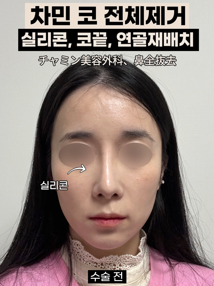 @차민성형외과의원