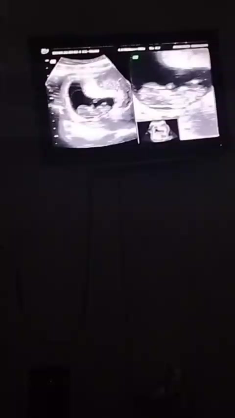 @Mayte Fern&aacute;ndez 19