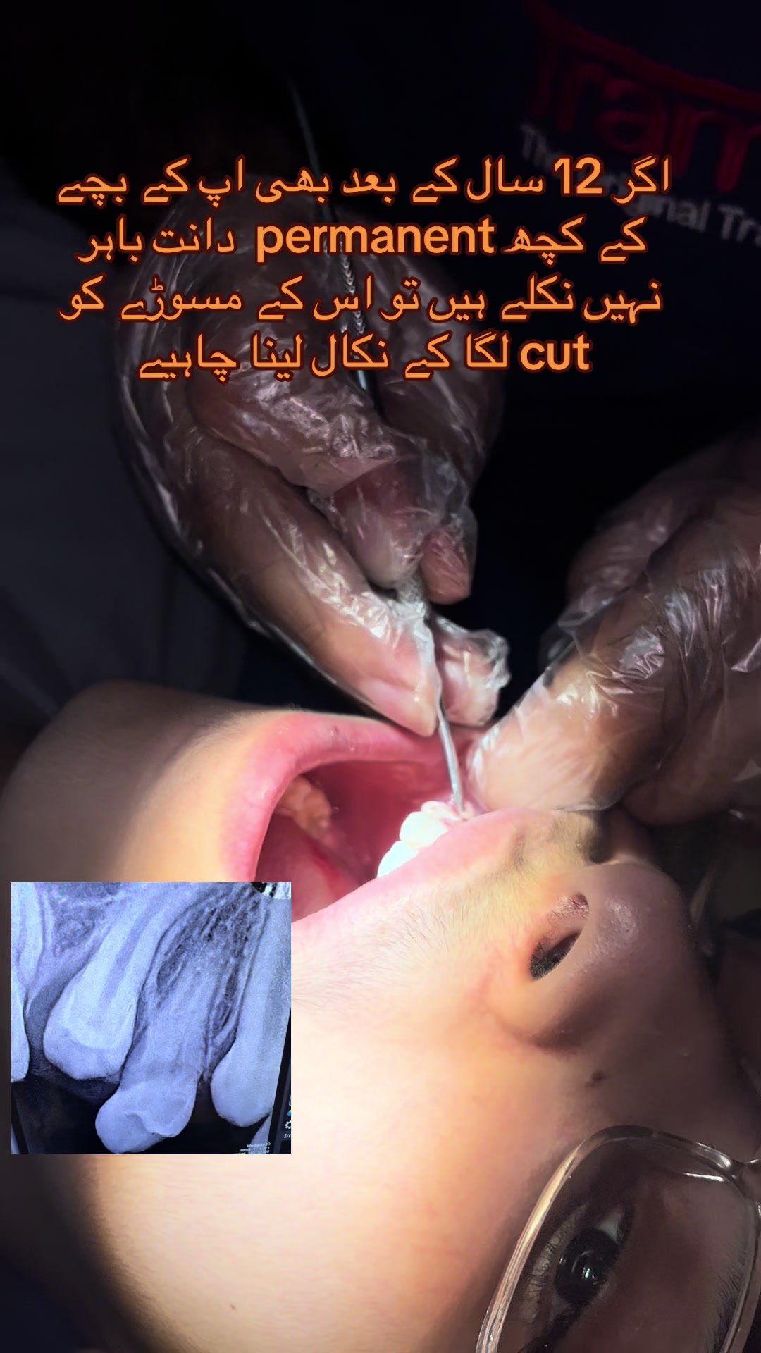 @Dr Hammad| Dental Surgeon