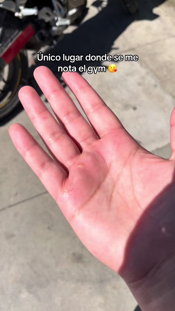 @a