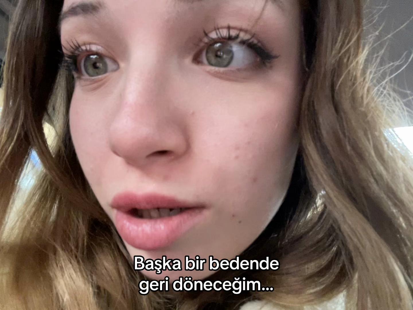 @Aceliyyy