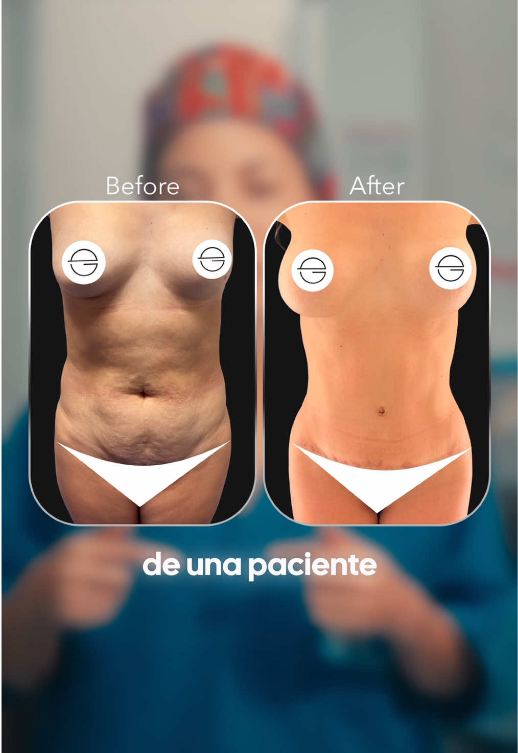 @Eliana Garc&eacute;s Plastic Surgery