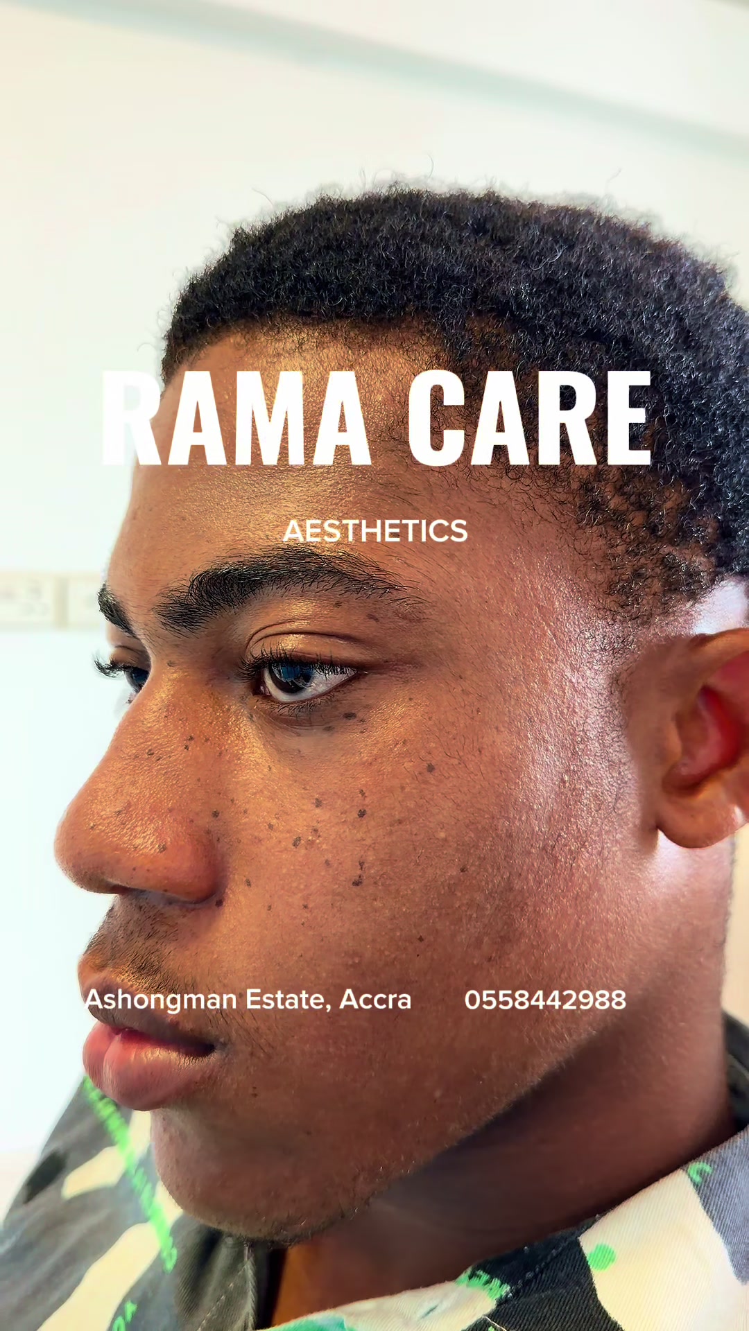@Rama Care Aesthetics