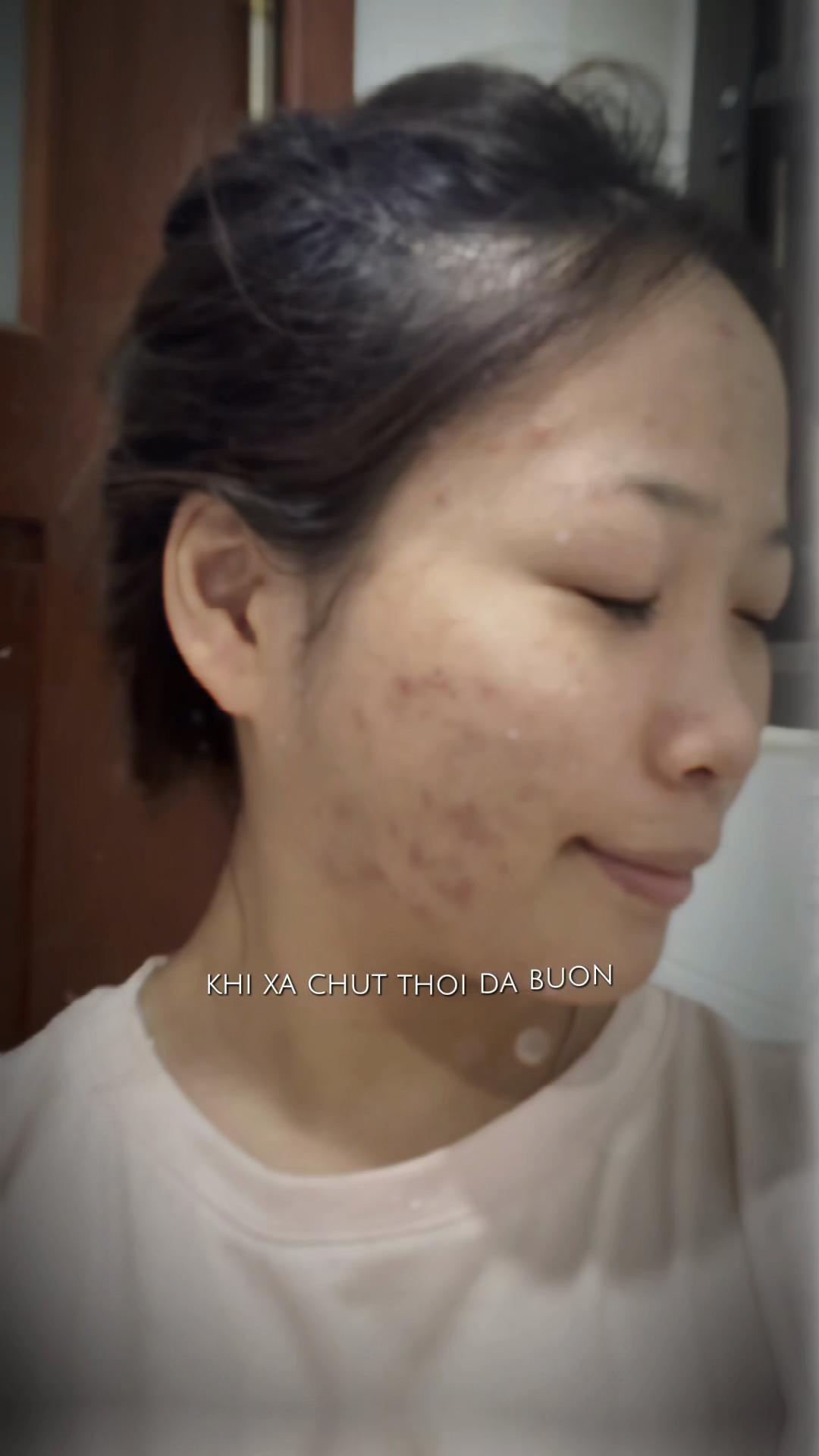 @Chi tiền làm đẹp