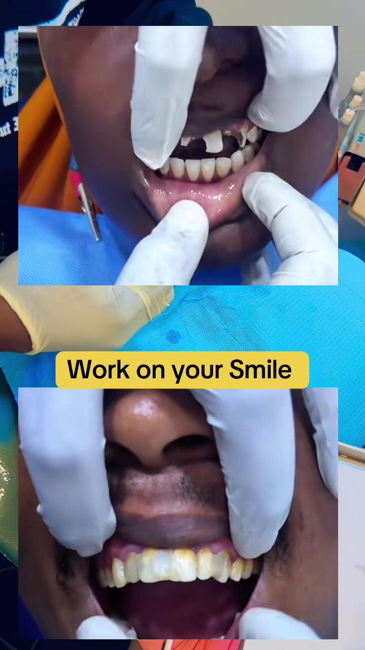 @Dr Sabila🦷🇺🇬🌍