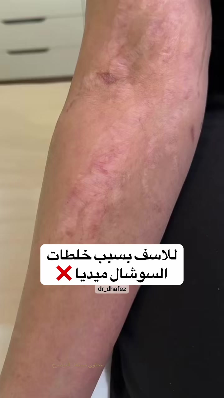 @د. ظافر آل حافظ