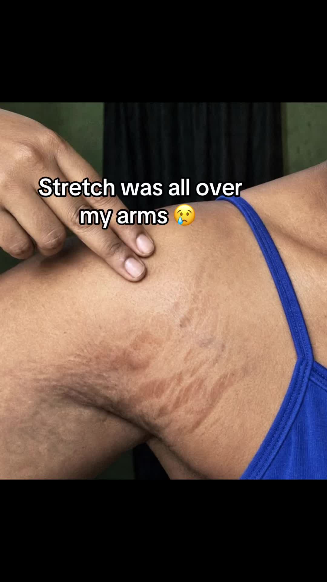 @Radiant skin