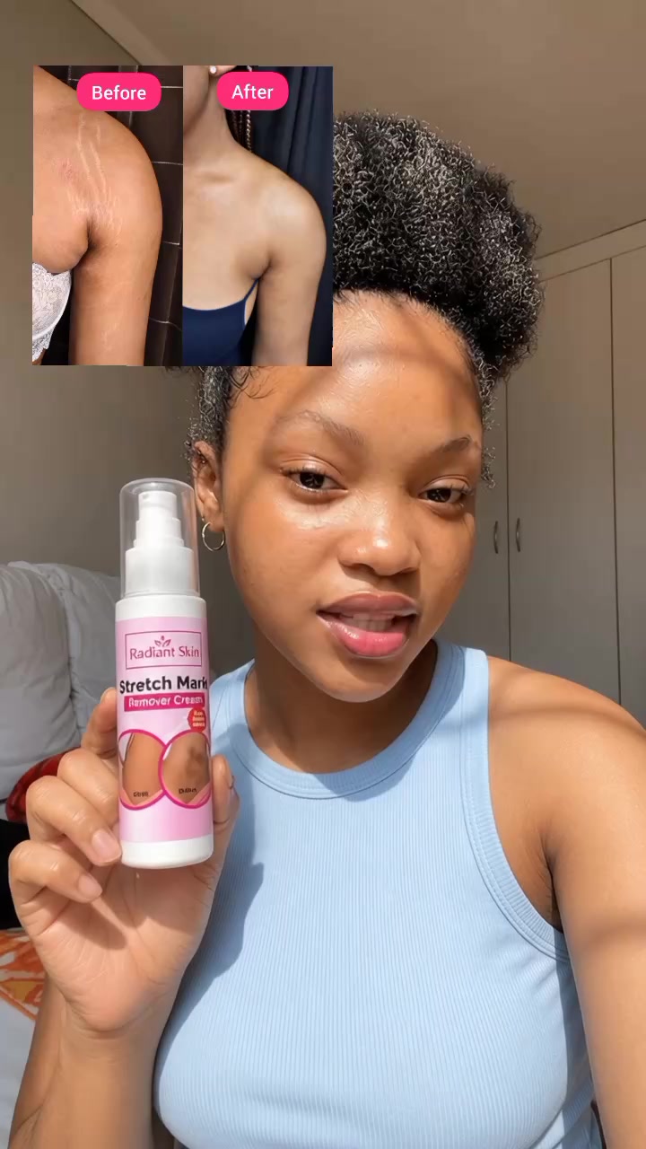 @Radiant skin