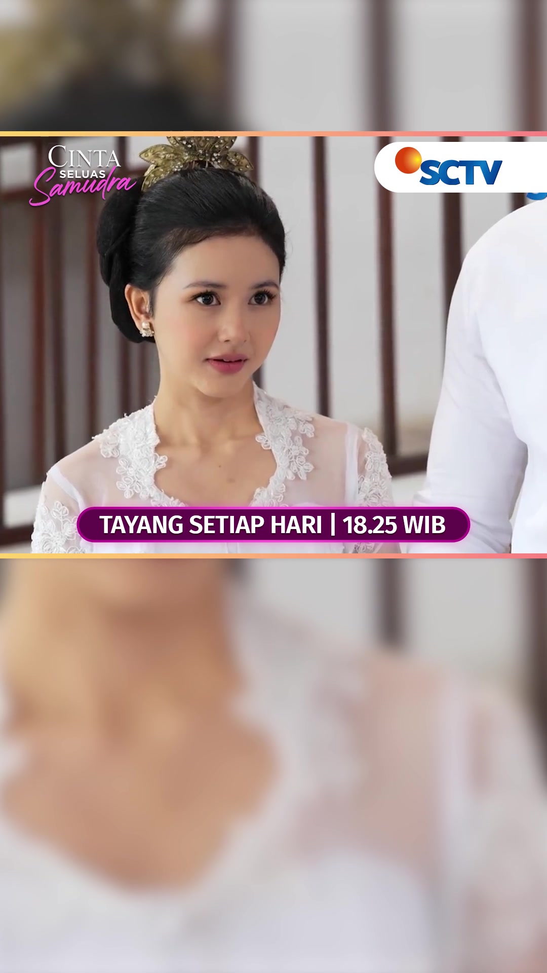 @SCTV