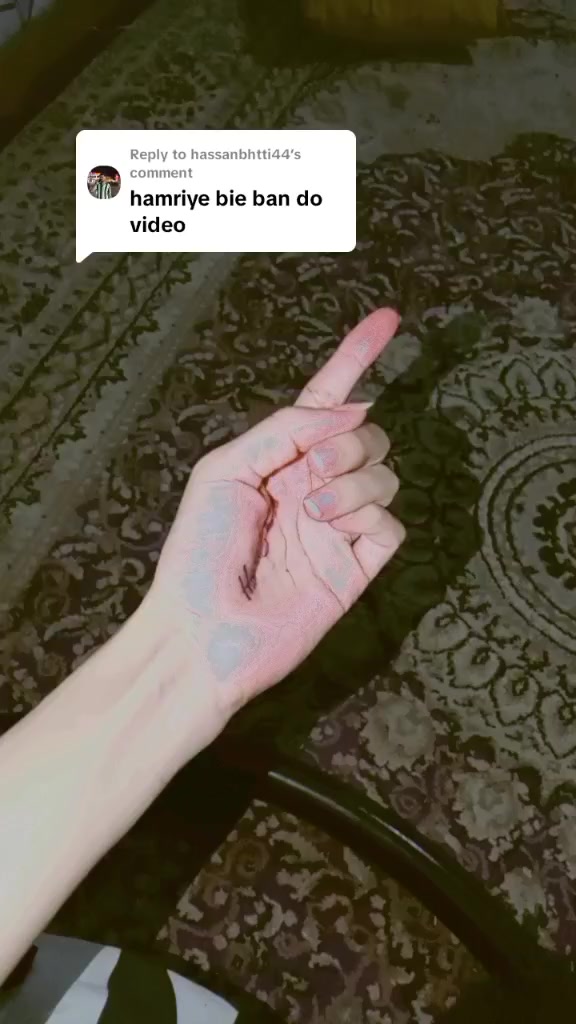 @ziddi hn yar 🥹