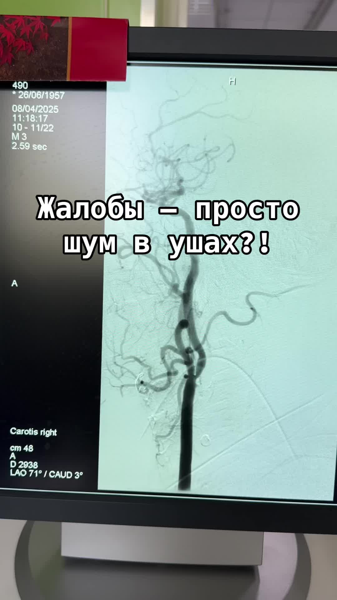 @Кардиолог / Аспет