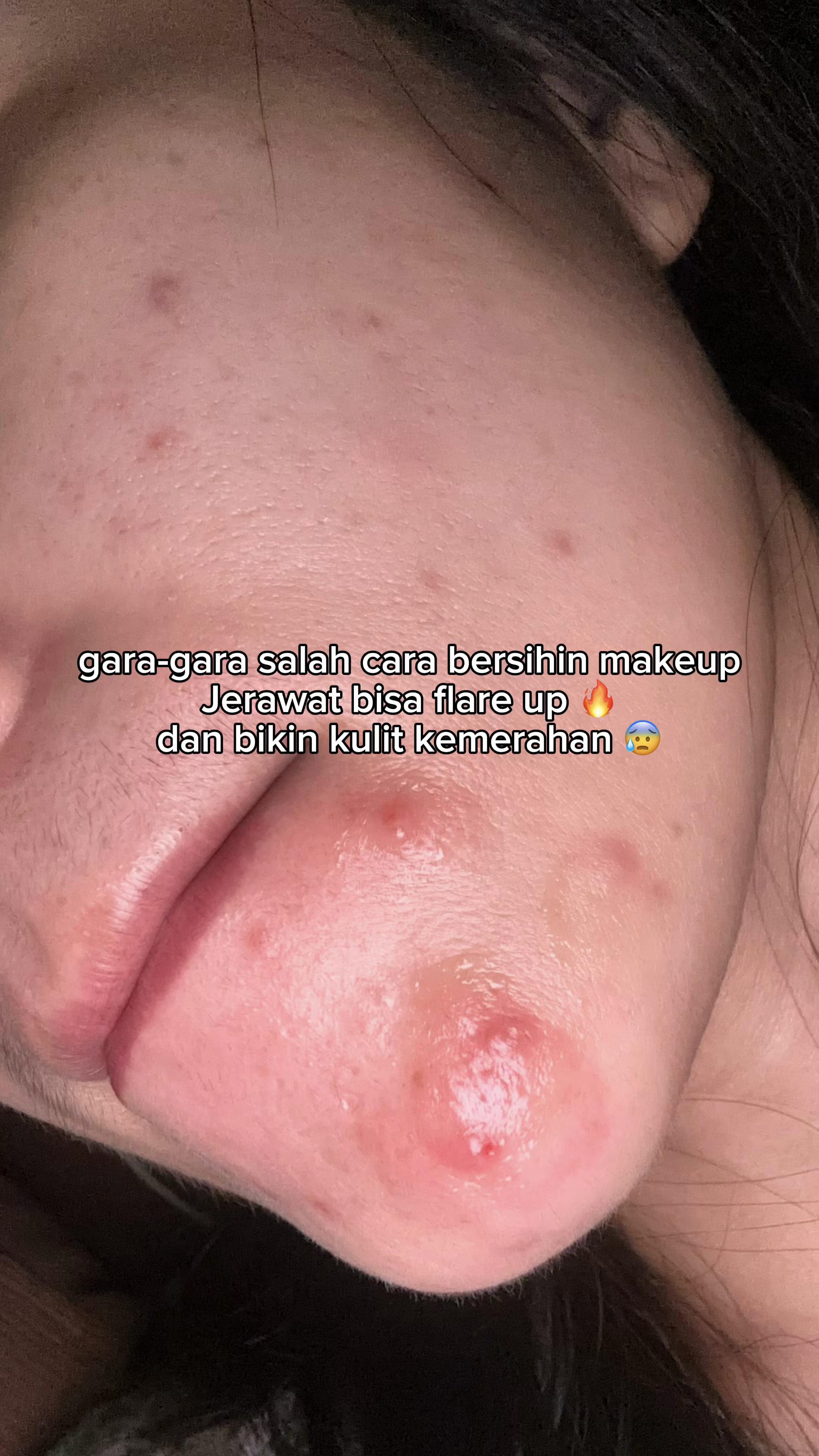 @Nonatyas