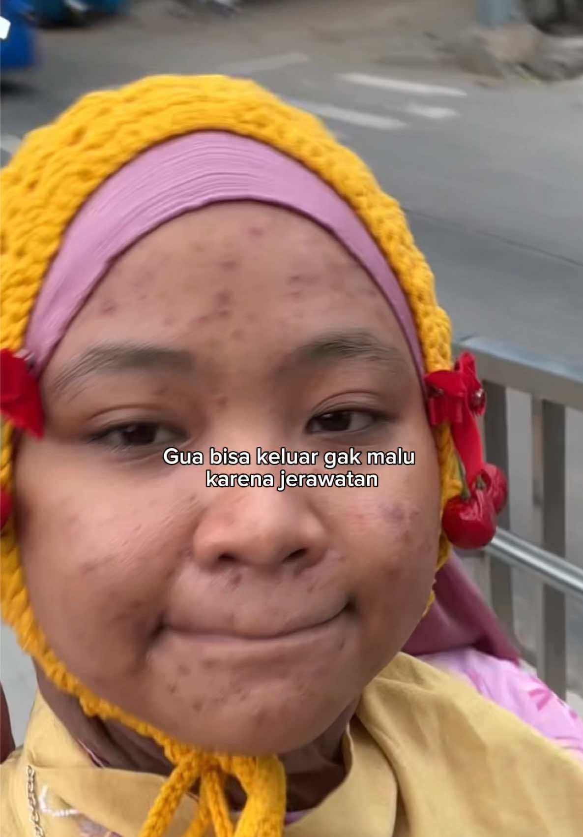 @MBAK CUNGCAT BAYI