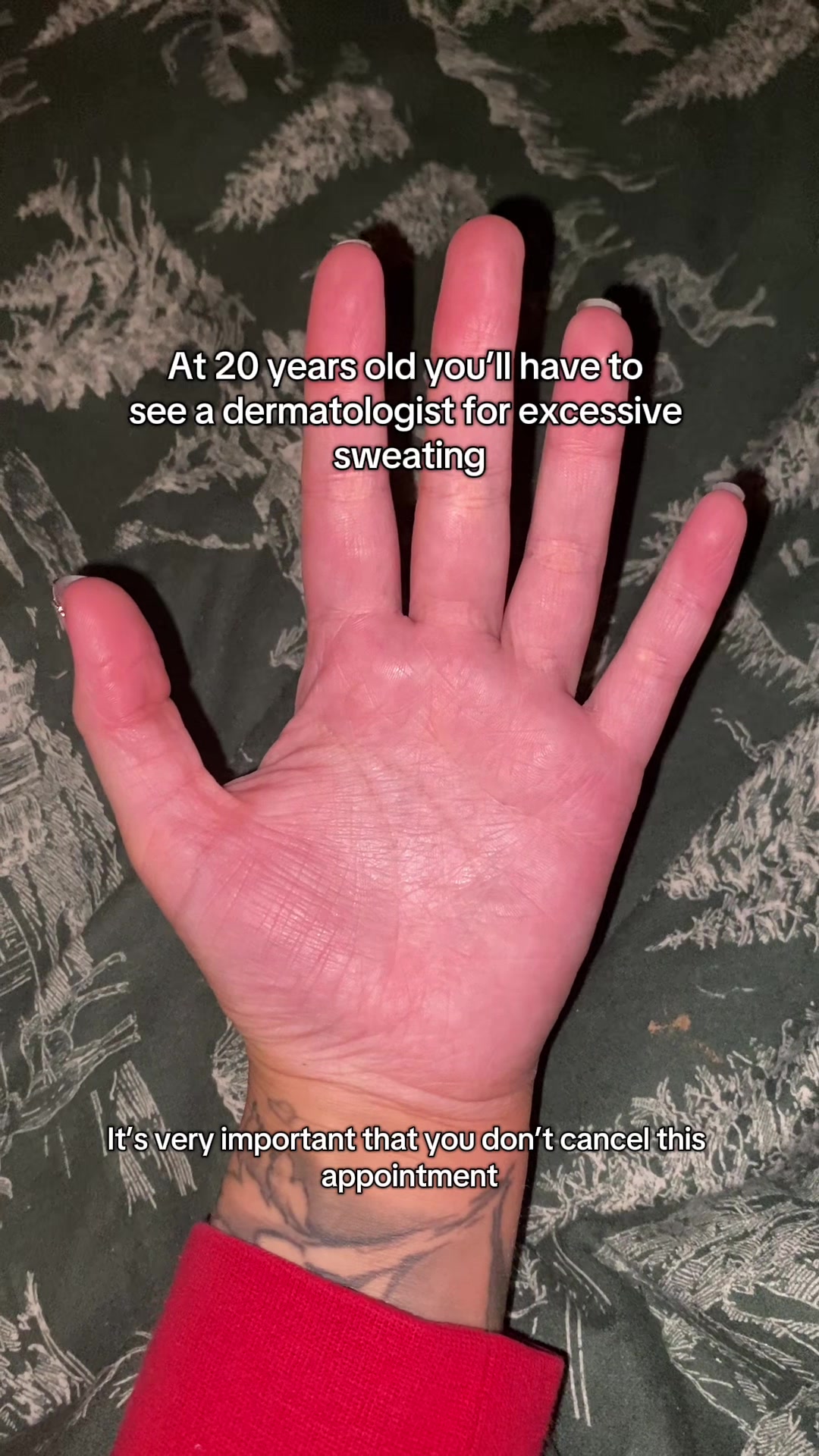 @LivingWithHyperhidrosis