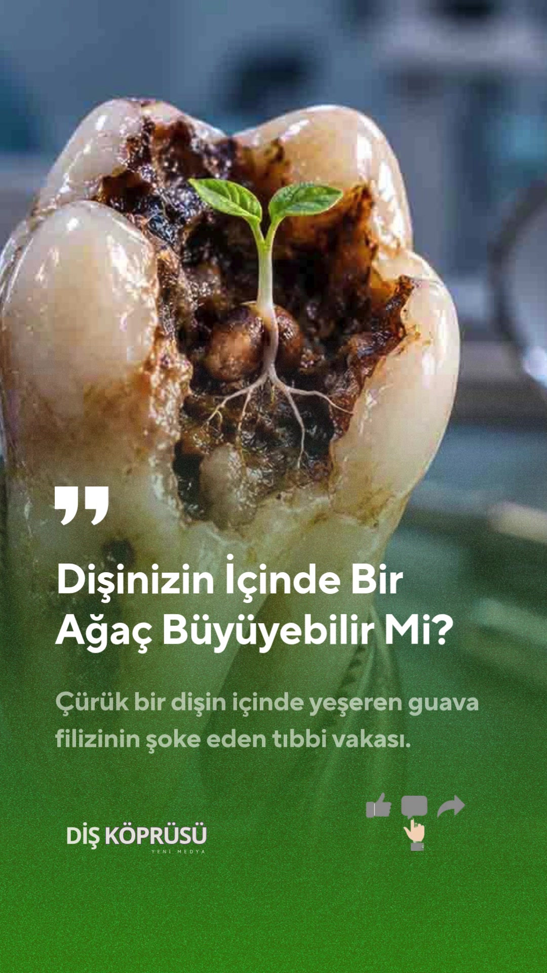 @Diş Köprüsü | Yeni Medya