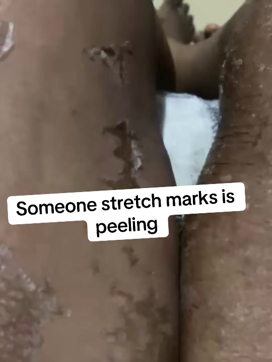 @@ Precious peeling soap