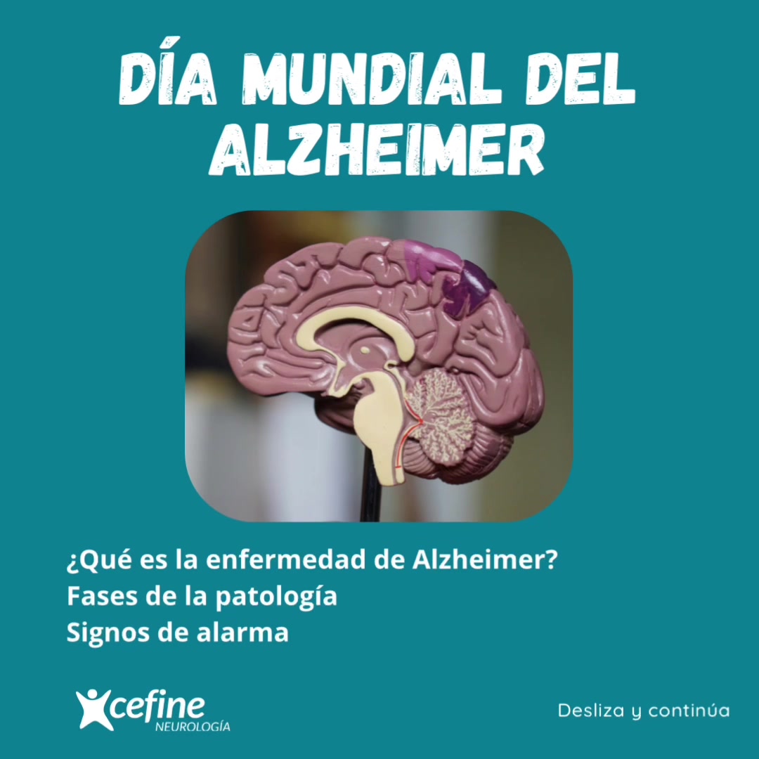 @Cefine Neurolog&iacute;a