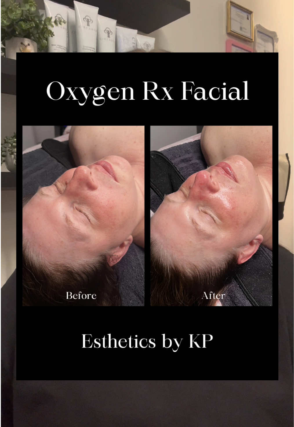 @kendyl | stl esthetician