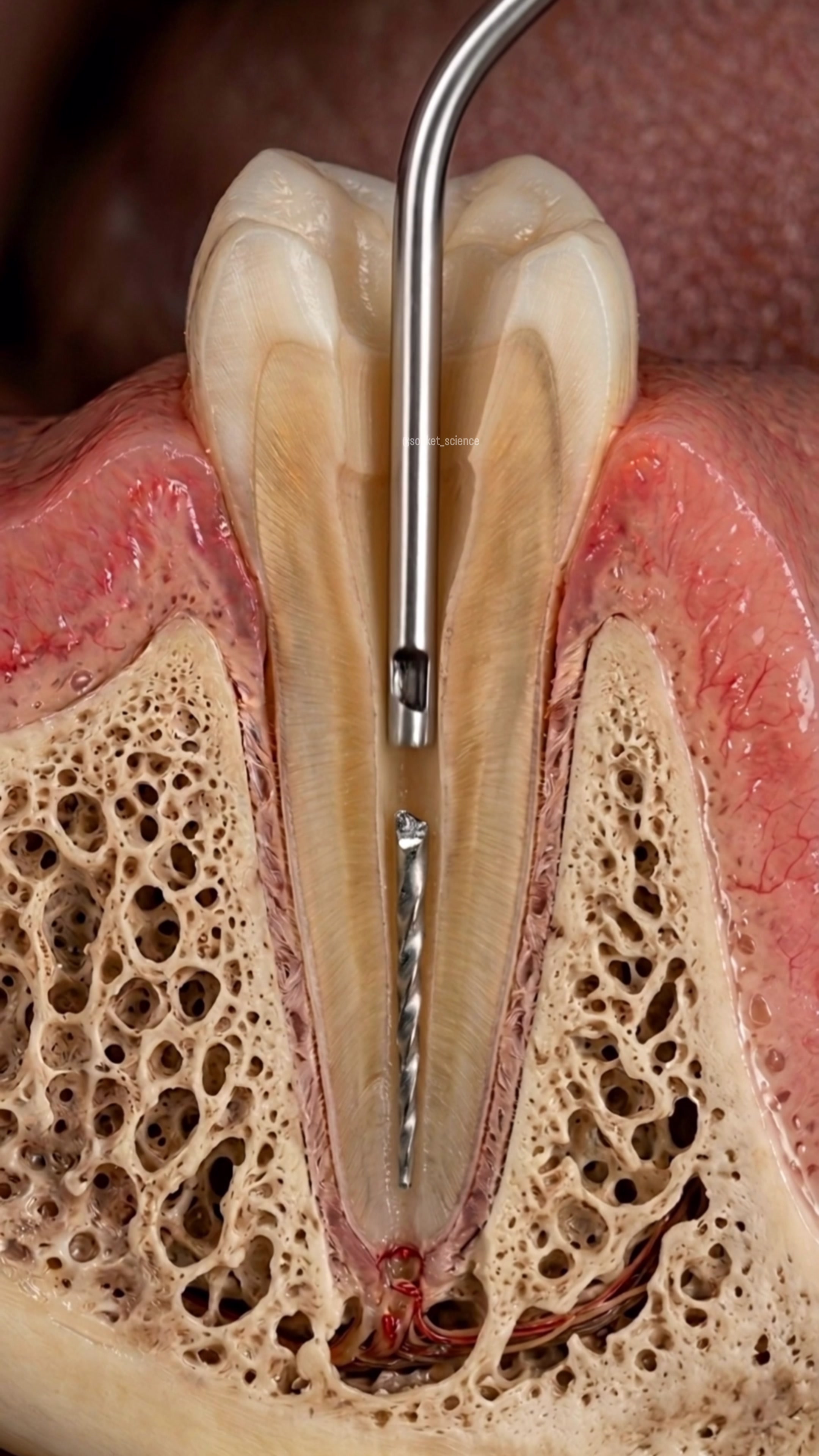 @Socket Science | Dental Visual