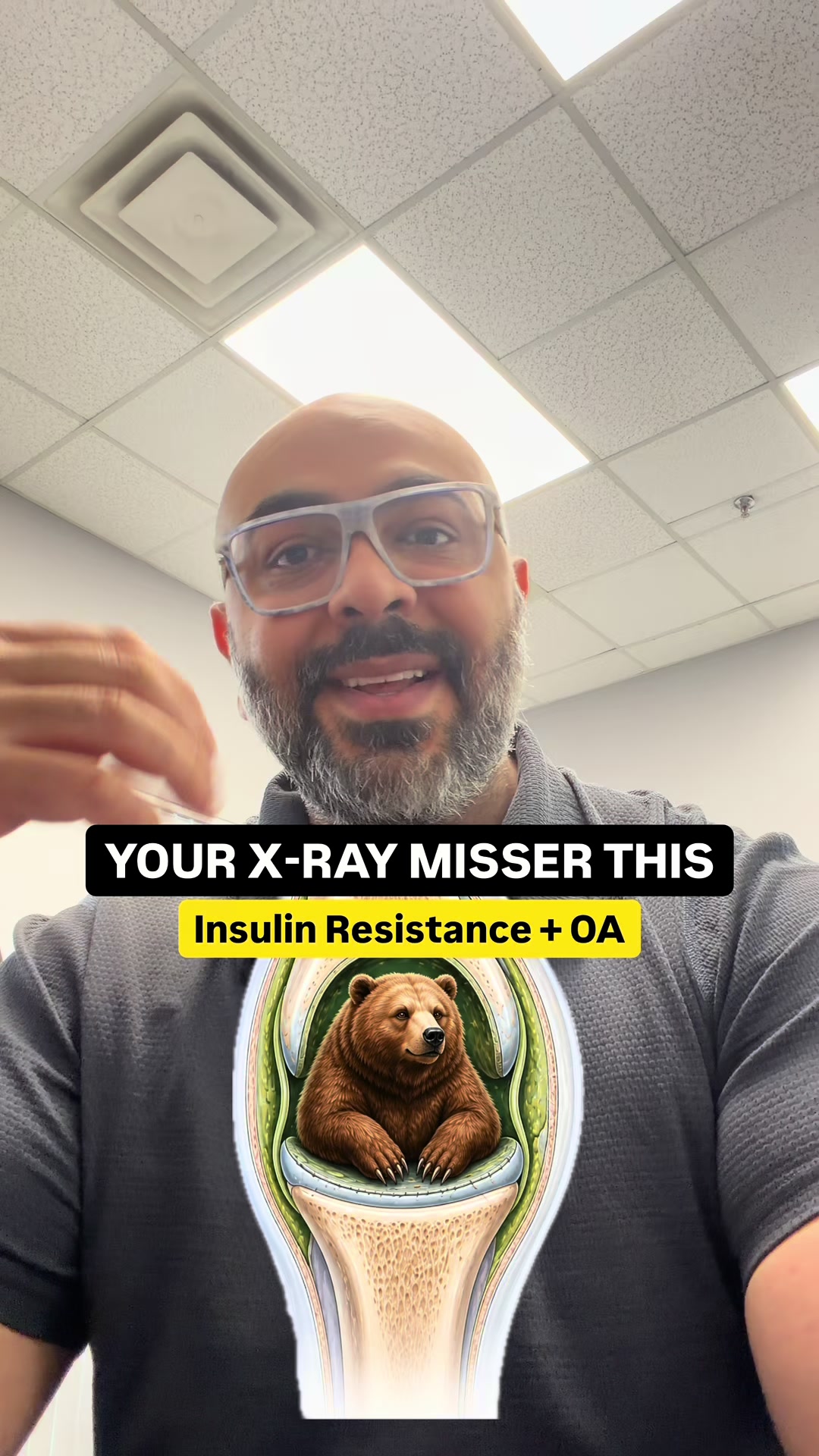 @Movability