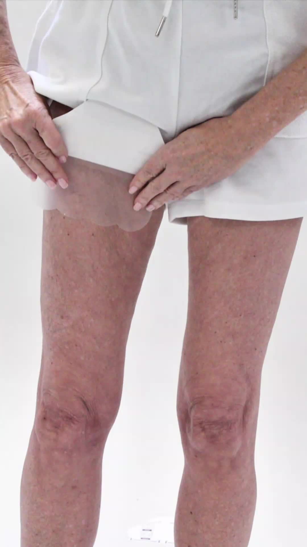 @Skinnies InstantLifts
