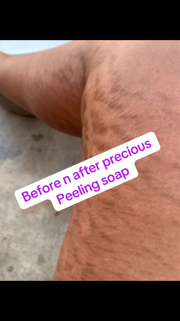 @@ Precious peeling soap