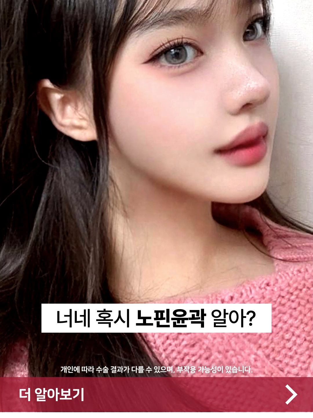 @디에이성형외과