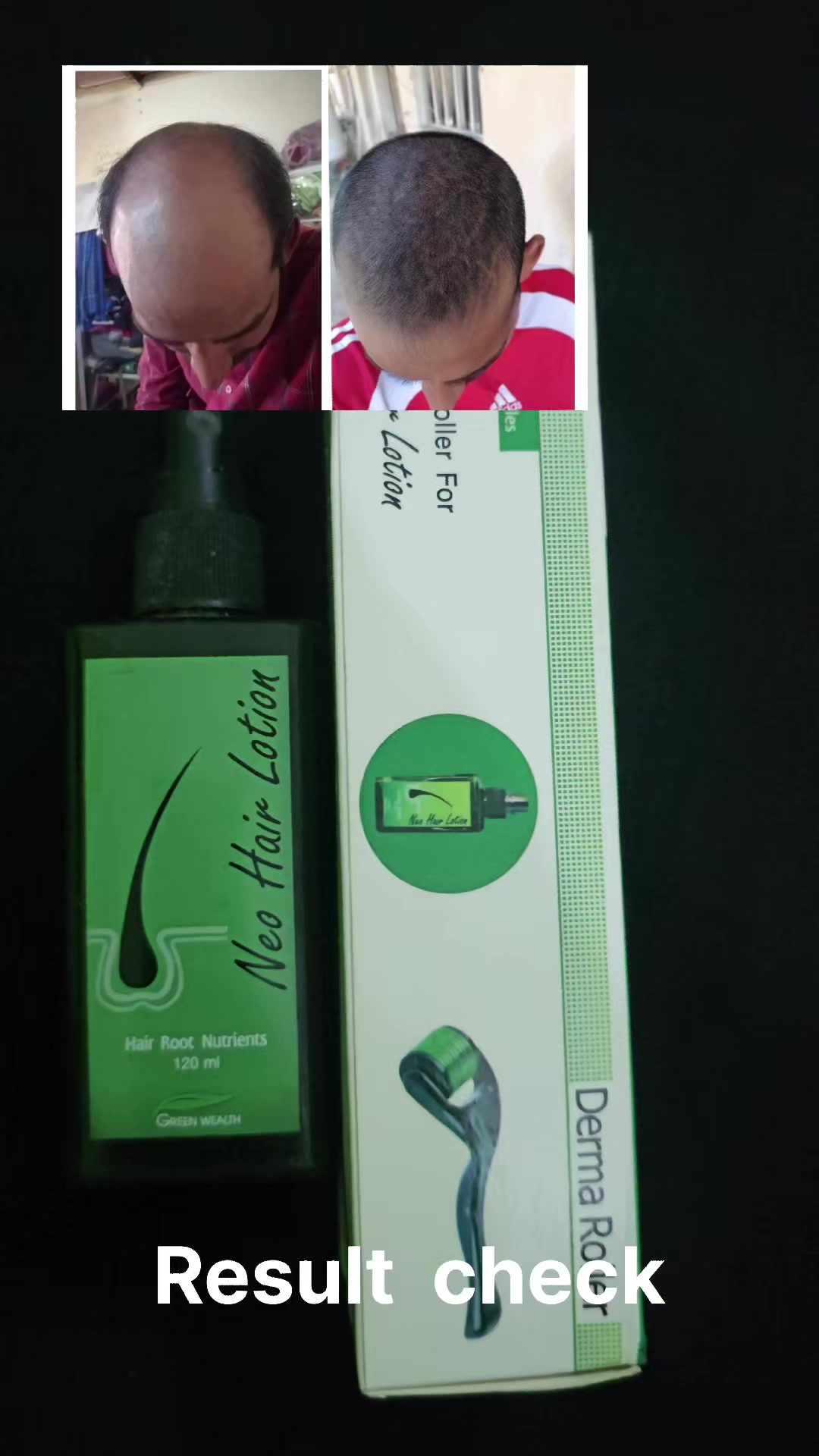 @Farooqui Lotion