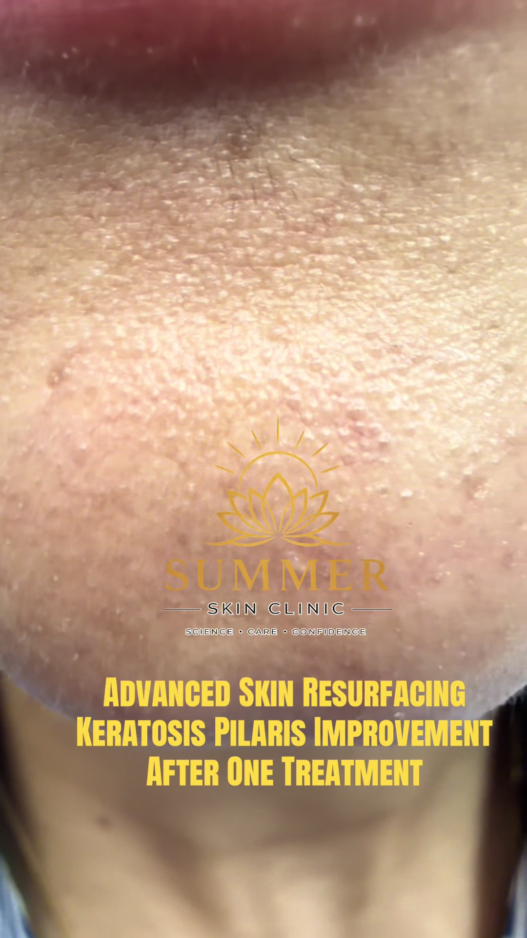 @Summer Skin Clinic | Toronto
